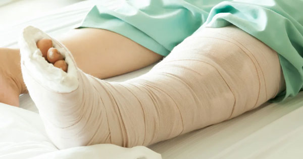 Complex fractures and its treatment methods