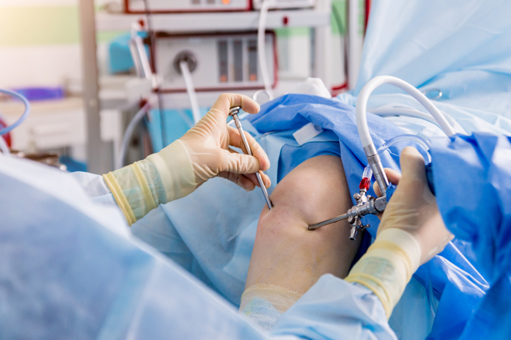 Arthroscopy Surgery